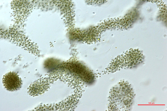 Cyanotoxin Removal from Drinking Water